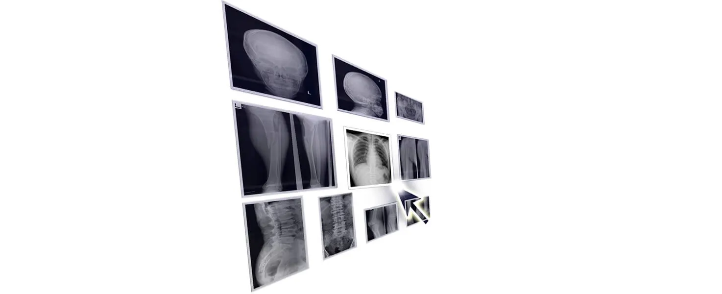 Imágenes radiológicas almacenadas en la nube (esquema PACS en nube)