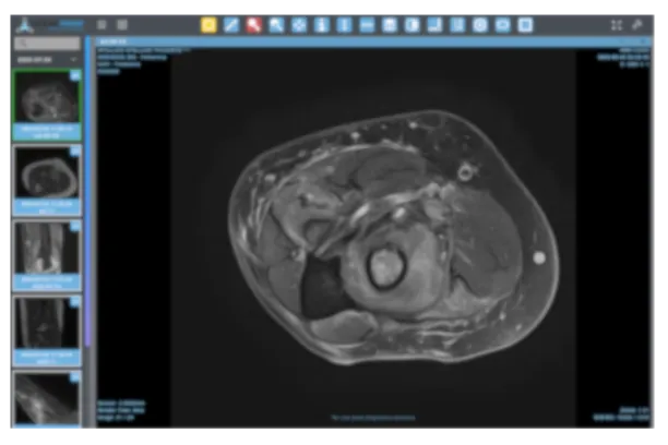 Visor DICOM mostrando una resonancia magnética axial de extremidad en ActualPACS