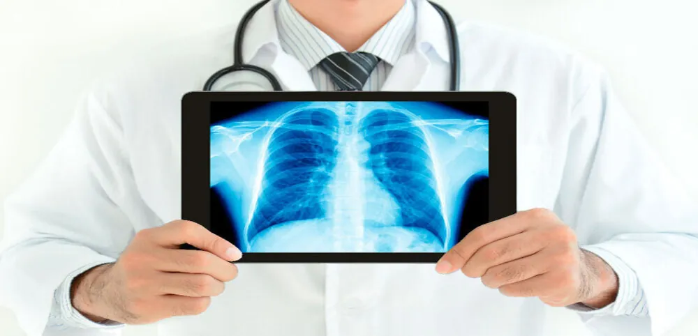 Radiografía de tórax mostrada en una tablet por un profesional sanitario